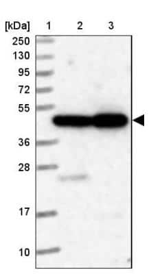 Western Blot: ELAC1 Antibody [NBP1-85337]