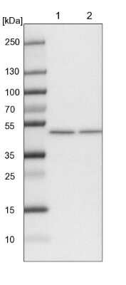 Western Blot: ELAC1 Antibody [NBP1-85337]