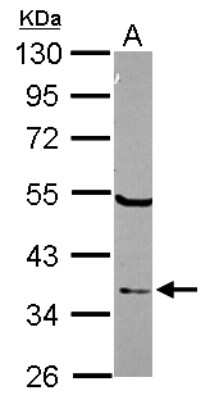 Western Blot: ELAC1 Antibody [NBP2-16313]
