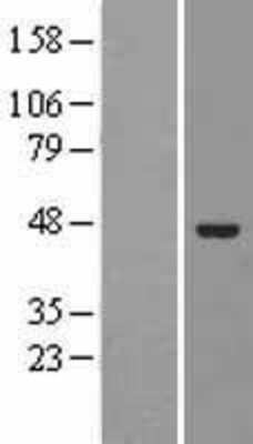 Western Blot: ELAC1 Overexpression Lysate [NBL1-10222]