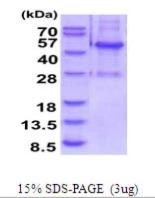 SDS-PAGE: Recombinant Human ELAC1 His Protein [NBP2-52119]