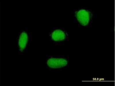Immunocytochemistry/ Immunofluorescence: ELAC2 Antibody [H00060528-B01P]