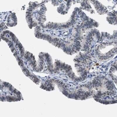 Immunohistochemistry-Paraffin: ELAC2 Antibody [NBP1-84620]