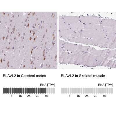 Immunohistochemistry-Paraffin: ELAVL2 Antibody [NBP2-38012]