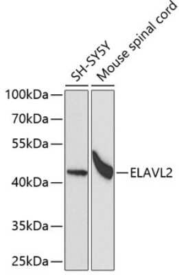 Western Blot: ELAVL2 AntibodyBSA Free [NBP3-03894]