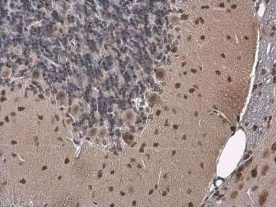 Immunohistochemistry-Paraffin: ELAVL4 Antibody [NBP3-13359]
