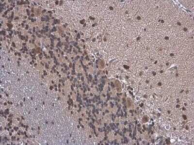 Immunohistochemistry-Paraffin: ELAVL4 Antibody [NBP3-13359]