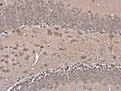 Immunohistochemistry-Paraffin: ELAVL4 Antibody [NBP3-13359]