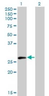 Western Blot: ELF5 Antibody (3D10) [H00002001-M01]