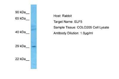 Western Blot: ELF5 Antibody [NBP2-87351]
