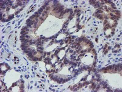 Immunohistochemistry-Paraffin: ELK3 Antibody (OTI1H3) [NBP2-01264]