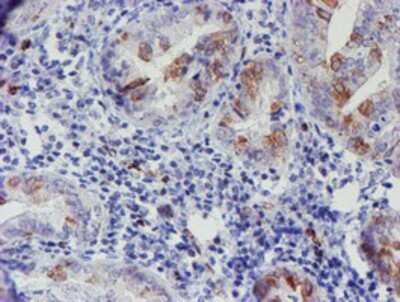 Immunohistochemistry: ELK3 Antibody (OTI1H3) - Azide and BSA Free [NBP2-70643]