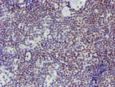 Immunohistochemistry: ELK3 Antibody (OTI1H3) - Azide and BSA Free [NBP2-70643]