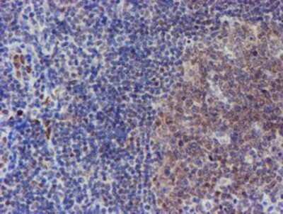 Immunohistochemistry: ELK3 Antibody (OTI1H3) - Azide and BSA Free [NBP2-70643]