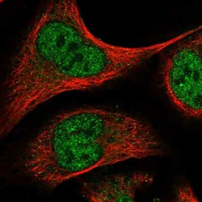 Immunocytochemistry/ Immunofluorescence: ELK4 Antibody [NBP1-87092]
