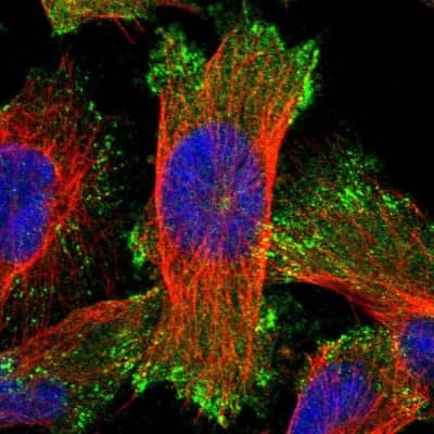 Immunocytochemistry/ Immunofluorescence: ELKS Antibody [NBP1-88179]