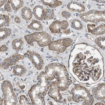 Immunohistochemistry-Paraffin: ELKS Antibody [NBP1-88179]