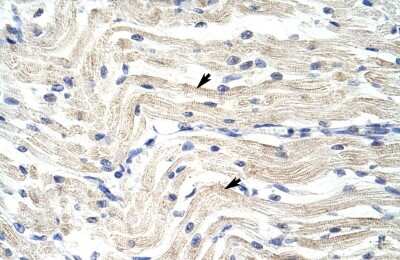 Immunohistochemistry: ELL Antibody [NBP2-82993]