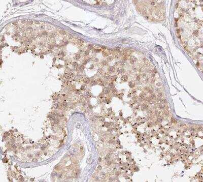 Immunohistochemistry-Paraffin: ELL3 Antibody [NBP1-82116]