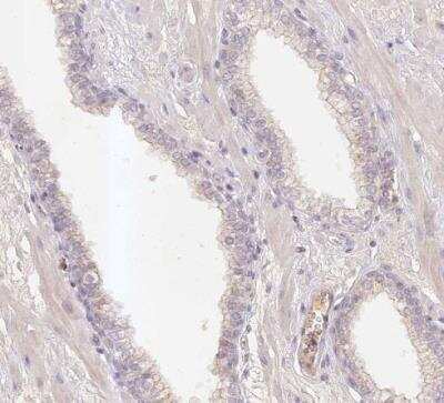Immunohistochemistry-Paraffin: ELL3 Antibody [NBP1-82116]