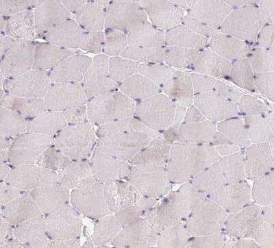 Immunohistochemistry-Paraffin: ELL3 Antibody [NBP1-82116]
