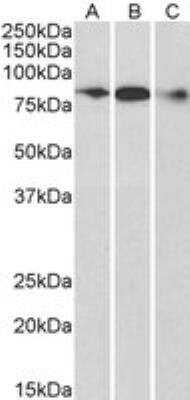 Immunoprecipitation: ELMO1 Antibody [NB100-875]