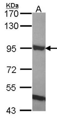 Western Blot: ELMO1 Antibody [NBP1-33645]