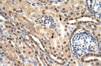 Immunohistochemistry: ELOB/ELOC/VHL Complex Antibody [NBP2-82356]