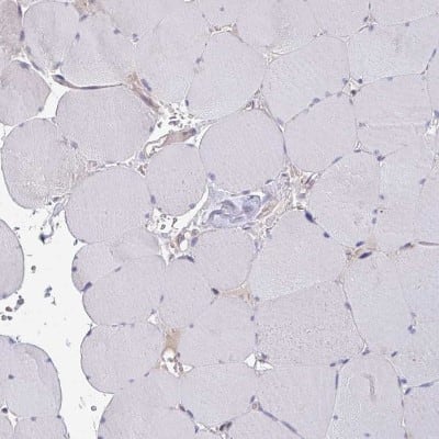 Immunohistochemistry-Paraffin: ELOVL1 Antibody [NBP2-37956]