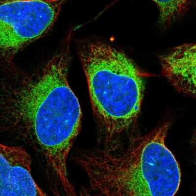 Immunocytochemistry/ Immunofluorescence: ELOVL5 Antibody [NBP2-33500]
