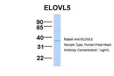 Western Blot: ELOVL5 Antibody [NBP1-59539]