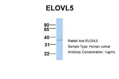 Western Blot: ELOVL5 Antibody [NBP1-59539]