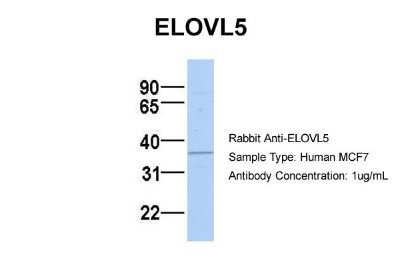 Western Blot: ELOVL5 Antibody [NBP1-59539]