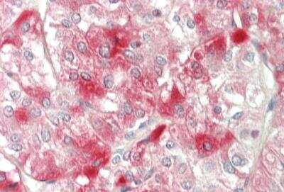Immunohistochemistry-Paraffin: ELOVL6 Antibody [NBP2-82998]
