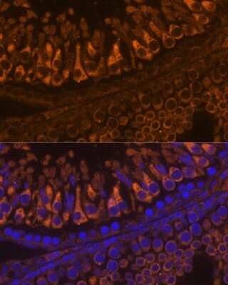 Immunohistochemistry: ELSPBP1 Antibody - Azide and BSA Free [NBP3-04400]