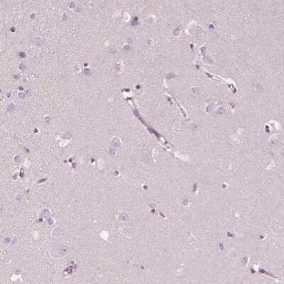 Immunohistochemistry-Paraffin: ELSPBP1 Antibody [NBP2-13957]