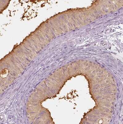 Immunohistochemistry-Paraffin: ELSPBP1 Antibody [NBP2-13957]