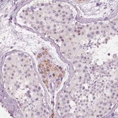 Immunohistochemistry-Paraffin: ELSPBP1 Antibody [NBP2-13957]