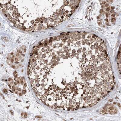Immunohistochemistry-Paraffin: ELYS Antibody [NBP1-87952]