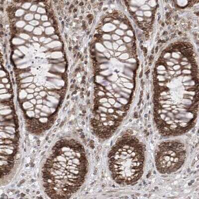 Immunohistochemistry-Paraffin: ELYS Antibody [NBP1-87952]