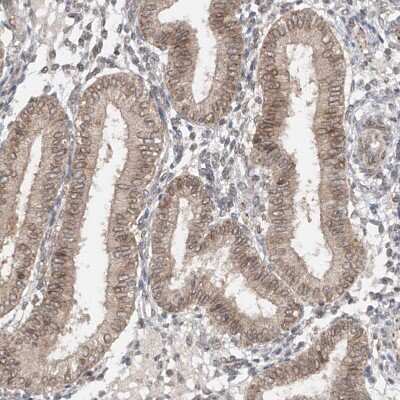 Immunohistochemistry-Paraffin: ELYS Antibody [NBP1-87952]