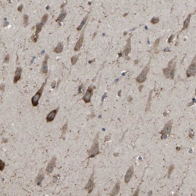 Immunohistochemistry-Paraffin: EMAP-II/AIMP1 Antibody [NBP1-84851]