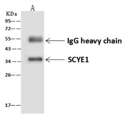 Immunoprecipitation: EMAP-II/AIMP1 Antibody [NBP2-99128]
