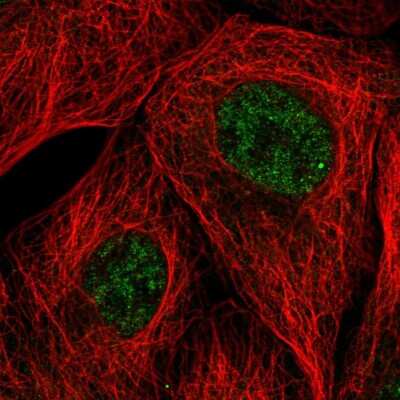 Immunocytochemistry/ Immunofluorescence: EMC7 Antibody [NBP2-57188]
