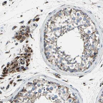 Immunohistochemistry-Paraffin: EMC7 Antibody [NBP1-88547]