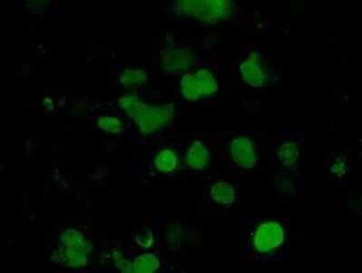Immunocytochemistry/ Immunofluorescence: EMG1 Antibody (OTI1B8) [NBP2-02575]