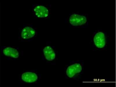 Immunocytochemistry/ Immunofluorescence: EMG1 Antibody [H00010436-B01P]