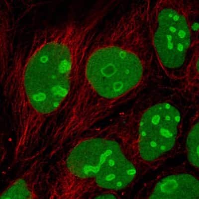 Immunocytochemistry/ Immunofluorescence: EMG1 Antibody [NBP2-55324]