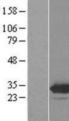 Western Blot: EMG1 Overexpression Lysate [NBL1-10254]