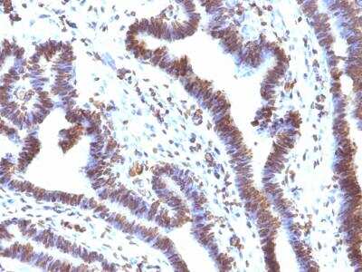 Immunohistochemistry-Paraffin: EMI1 Antibody (EMI1/1176) - IHC-Prediluted [NBP2-48221]